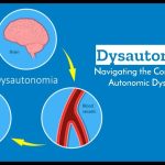 Dysautonomia
